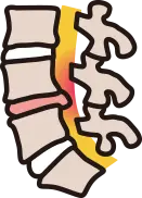 염증 완화 및 신경 유착 분해 등 원인 치료 효과 안내