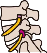 풍선이 내장된 특수 카테터를 이용한 풍선확장술 장비 안내