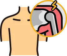 석회성 건염 및 오십견 등 어깨 질환 치료 적응증 안내