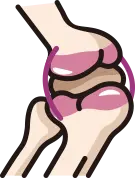 인공관절 전치환술 장점 안내