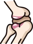 인공관절 부분치환술 장점 안내