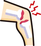 말기 관절염 및 염증성 질환 시 연골판 이식술 제한 사항 안내