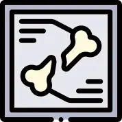 영상 진단을 통한 골절의 안정성 및 치료 방법 결정 안내