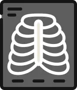 깁스 고정 없이 안정을 취하는 갈비뼈 골절 치료 안내