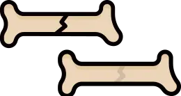 뼈의 유합 기간 관련 자주 묻는 질문