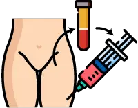 자가 골수 흡입 농축물(BMAC) 줄기세포 주사 치료를 위한 골수 채취 및 시술 단계 안내