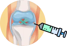 초음파 유도 하에 정확한 병변 부위에 주사하는 시술 안내 아이콘