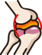 성장인자 분비 촉진을 통한 인대 및 연골 조직 재생 유도 아이콘