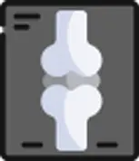 영상 검사를 통한 콘쥬란 치료 여부 진단 단계 안내