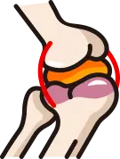 콜라겐 생성 및 혈관 형성을 통한 인대 강화 과정 안내