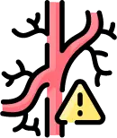 내경동맥이 좁아지는 모야모야병의 혈관 협착 상태 안내