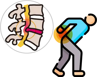 추간판 탈출증(허리 디스크)의 신경 압박 기전 안내