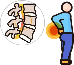 척추관협착증의 척추관 협소 및 신경 압박 안내