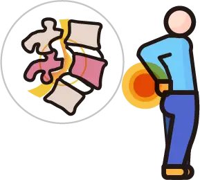 척추전방전위증의 척추뼈 어긋남 및 신경 압박 안내