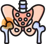 선천적 관절 구조 이상으로 인한 고관절 이형성증 안내 아이콘