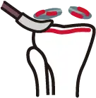 제거된 연골판 부위에 새로운 타인 연골판을 삽입하여 기능을 복원하는 이식술