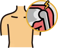 어깨 근육 이완 및 가동성 회복을 위한 전문 도수치료 시술 장면