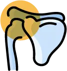 외상으로 인한 어깨 관절의 연골 손상 및 관절염 진행 양상