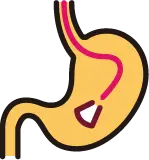 위암 예방을 위한 40세 이상 위내시경 검사 안내