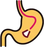 속쓰림 및 소화불량 등 위 내시경 검사가 필요한 주요 증상 가이드