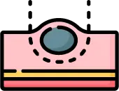 검사 중 발견된 용종의 즉각적인 절제 및 전문 조직검사 시행