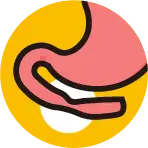 염증 또는 종양으로 인해 십이지장 통로가 폐쇄된 협착 상태