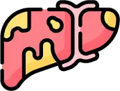 간세포 내 지방이 쌓여 염증을 유발하는 지방간의 진행 단계 안내