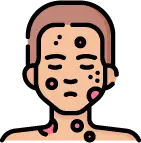 사마귀, 여드름, 탈모 등 기타 피부 질환 증상 이미지